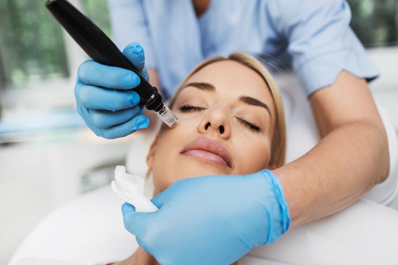 Microneedling treatment at New Journey Medical & Aesthetics